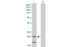 Western Blot analysis of NDUFS4 expression in transfected 293T cell line by NDUFS4 monoclonal antibody (M01), clone 1A1. (NDUFS4 antibody  (AA 66-175))