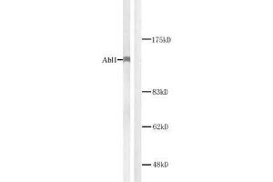 Western blot analysis of extracts from K562 cells. (ABL1 antibody)
