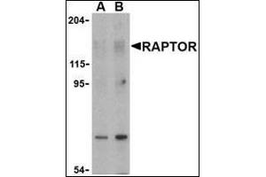 Western blot analysis of Raptor in L1210 cell lysate with this product at (A) 2 and (B) 4 μg/ml. (RAPTOR antibody  (N-Term))