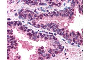 Immunohistochemistry (IHC) image for anti-Tumor Necrosis Factor Receptor Superfamily, Member 10b (TNFRSF10B) (C-Term) antibody (ABIN213934)