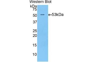 Western blot analysis of the recombinant protein. (TGM1 antibody  (AA 504-737))