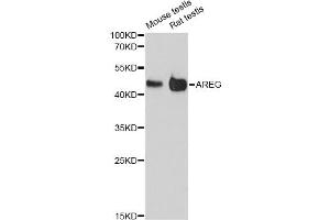 Western blot analysis of extracts of various cell lines, using AREG antibody (ABIN6290061) at 1:3000 dilution. (Amphiregulin antibody)