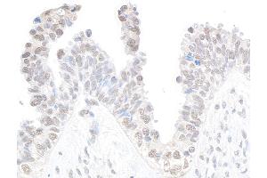 anti-Cyclin-Dependent Kinase 11B (CDK11B) (C-Term) antibody