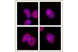 SMARCA2 / BRM antibody (mAb) tested by Immunofluorescence. (SMARCA2 antibody  (AA 48-214))