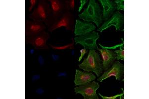 ABIN7094698 and ABIN7098749 staining  cells by IF/ICC. (TIMM50 antibody  (C-Term))