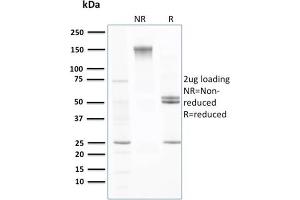 SDS-PAGE Analysis Purified Transthyretin Mouse Monoclonal Antibody (CPTC-TTR-1). (TTR antibody)
