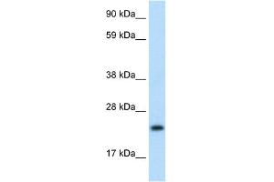 WB Suggested Anti-ASCL1 Antibody Titration:  1. (ASCL1 antibody  (N-Term))