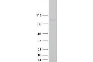 Western Blotting (WB) image for Centromere Protein T (CENPT) protein (Myc-DYKDDDDK Tag) (ABIN2713913)