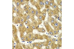 Immunohistochemistry of paraffin-embedded human liver injury using MYO1C antibody at dilution of 1:100 (x40 lens). (Myosin IC antibody)
