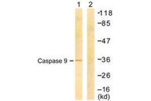 Western blot analysis of extracts from COS7 cells, treated with Etoposide 25uM 24h, using Caspase 9 (Ab-144) Antibody. (Caspase 9 antibody  (AA 110-159))