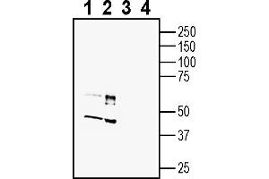 Western blot analysis of mouse brain membranes (lanes 1 and 3) and rat brain membranes (lanes 2 and 4):1-2. (C3AR1 antibody  (Extracellular))