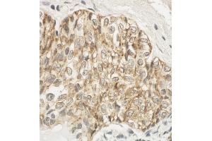 Immunohistochemistry (IHC) image for anti-F11 Receptor (F11R) (AA 249-299) antibody (ABIN7453715) (F11R antibody  (AA 249-299))