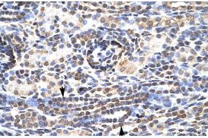 Rabbit Anti-KL9 Antibody  Paraffin Embedded Tissue: Human Kidney Cellular Data: Epithelial cells of renal tubule Antibody Concentration: 4. (KLF9 antibody  (N-Term))