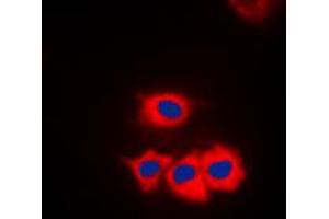 Immunofluorescent analysis of CK1 gamma 1 staining in Jurkat cells. (CSNK1G1 antibody  (N-Term))