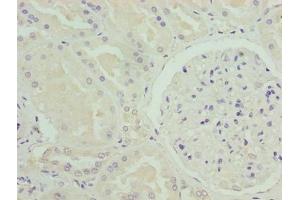 Immunohistochemistry of paraffin-embedded human kidney tissue using ABIN7161010 at dilution of 1:100 (NADPH Oxidase 4 antibody  (AA 210-424))