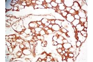 Mouse visceral fat tissue was stained by Rabbit Anti-Cathepsin S (298-331) (Human) Serum (Cathepsin S antibody  (AA 298-331))