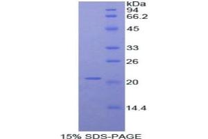 SDS-PAGE analysis of Mouse ADAMTS12 Protein. (ADAMTS12 Protein)