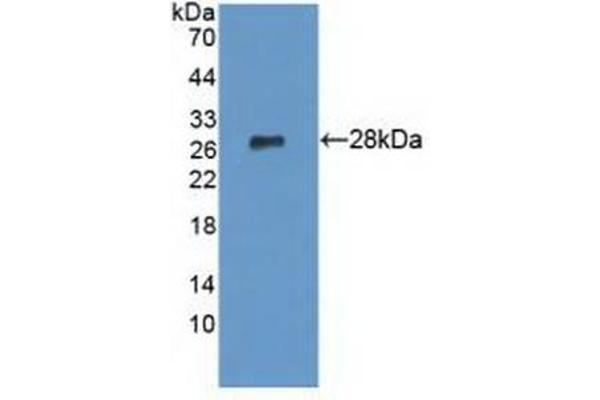LYPLA1 抗体  (AA 1-230)