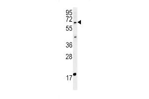 MKRN3 Antibody (Center) (ABIN651835 and ABIN2840417) western blot analysis in MDA-MB435cell line lysates (15 μg/lane). (MKRN3 antibody  (AA 160-189))