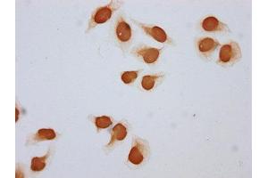 Immunocytochemistry analysis of ABIN7139147 diluted at 1:5 and staining in Hela cells (treated with 30mM sodium butyrate for 4h) performed on a Leica BondTM system. (Histone H2B antibody  (acLys108))