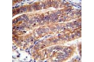 NUMB antibody immunohistochemistry analysis in formalin fixed and paraffin embedded human uterus tissue. (NUMB antibody  (AA 1-30))