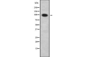 Western blot analysis SLC9A2 using COLO205 whole cell lysates (SLC9A2 antibody  (Internal Region))