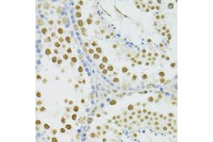 Immunohistochemistry of paraffin-embedded mouse testis using BRCA1 antibody (ABIN5997316) at dilution of 1/100 (40x lens). (BRCA1 antibody)