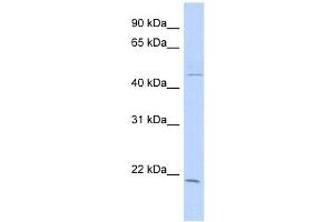 CIB3 antibody used at 1 ug/ml to detect target protein. (CIB3 antibody  (N-Term))