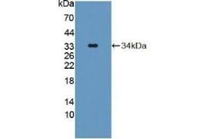 Detection of Recombinant TAT, Mouse using Polyclonal Antibody to Tyrosine Aminotransferase (TAT) (TAT antibody  (AA 190-454))