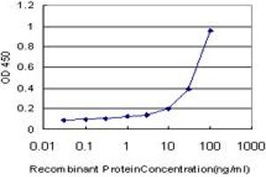 Detection limit for recombinant GST tagged MT is approximately 1ng/ml as a capture antibody. (MCAT antibody  (AA 291-390))