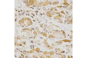 Immunohistochemistry of paraffin-embedded human stomach using OLR1 antibody at dilution of 1:200 (x400 lens).