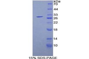 SDS-PAGE (SDS) image for Glutathione S-Transferase alpha 1 (GSTA1) ELISA Kit (ABIN6574174)