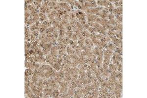 Immunohistochemical staining (Formalin-fixed paraffin-embedded sections) of human liver with MINA polyclonal antibody  shows strong nuclear and cytoplasmic positivity in hepatocytes. (MINA antibody)