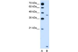 WB Suggested Anti-SLC46A3 Antibody Titration:  2. (SLC46A3 antibody  (N-Term))