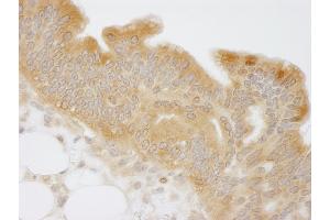 anti-N-Myc (And STAT) Interactor (NMI) (C-Term) antibody