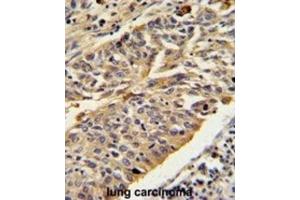 Immunohistochemistry (IHC) image for anti-Cathepsin E (CTSE) antibody (ABIN3002688) (Cathepsin E antibody)