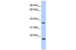 KCNMB3 antibody used at 1 ug/ml to detect target protein. (KCNMB3 antibody  (Middle Region))