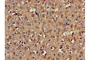 Immunohistochemistry of paraffin-embedded human brain tissue using ABIN7142041 at dilution of 1:100