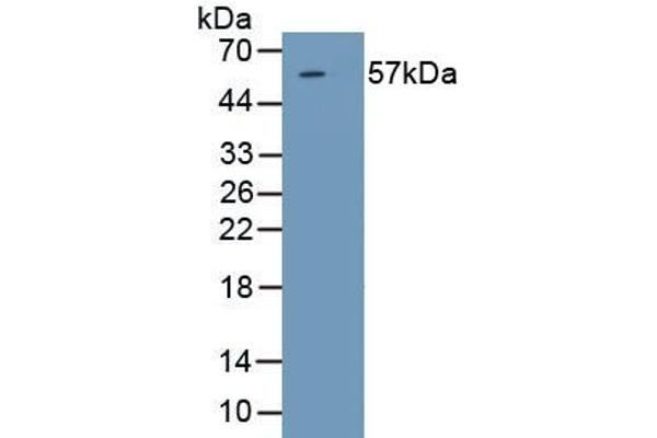 SRD5A1 antibody