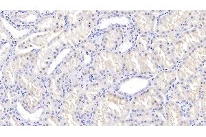 Detection of TGFb3 in Human Kidney Tissue using Polyclonal Antibody to Transforming Growth Factor Beta 3 (TGFb3) (TGFB3 antibody  (AA 274-372))