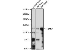 Western blot analysis of extracts of various cell lines, using TMEM67 antibody (ABIN6293383) at 1:1000 dilution. (TMEM67 antibody)