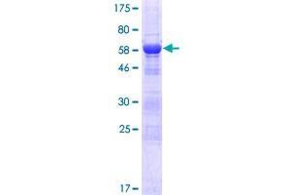 IFT46 Protein (AA 1-304) (GST tag)