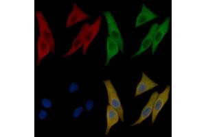 alpha-Actinin Mouse Monoclonal Antibody staining Hela cells by IF/ICC.