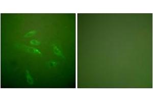 Immunofluorescence analysis of HeLa cells, using Collagen III Antibody.