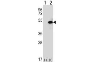 Western blot analysis of SPHK1 antibody and 293 cell lysate (2 ug/lane) either nontransfected (Lane 1) or transiently transfected (2) with the SPHK1 gene.
