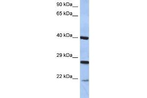 WB Suggested Anti-CIDEB Antibody Titration:  0. (CIDEB antibody  (Middle Region))