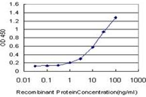Detection limit for recombinant GST tagged IRAK4 is approximately 1ng/ml as a capture antibody. (IRAK4 antibody  (AA 1-130))