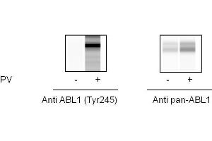 Jurkat cells were treated with Pervanadate. (ABL1 ELISA Kit)