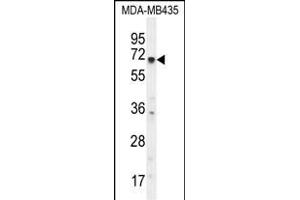 KCNQ1 Antibody (N-term) (ABIN656077 and ABIN2845424) western blot analysis in MDA-M cell line lysates (35 μg/lane).