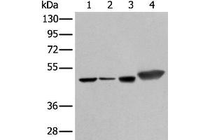 Western blot analysis of Hepg2 A431 Hela and A549 cell lysates using PLAG1 Polyclonal Antibody at dilution of 1:250 (PLAG1 antibody)